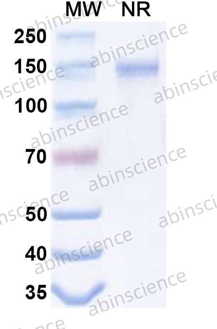 Anti-Ocrelizumab Non-Neutralizing Recombinant Antibody (SAA2633)