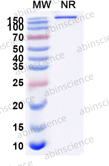 Anti-Ocrelizumab Non-Neutralizing Recombinant Antibody (SAA2634)