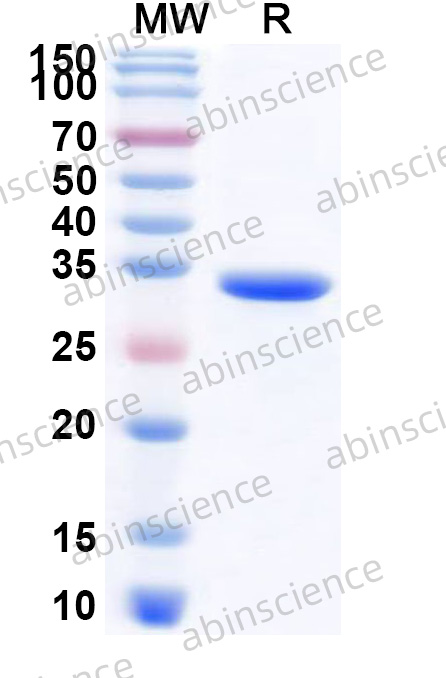 Recombinant Bovine CSN1S1/Bos d 8, N-His