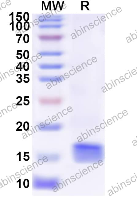 Bovine LALBA/Bos d 4 Recombinant Protein (N-His)