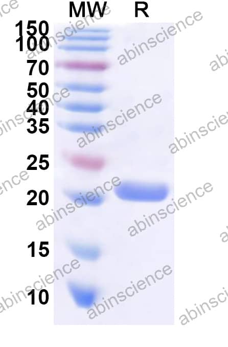 Canine Siglec-2/CD22 Recombinant Protein (N-His)