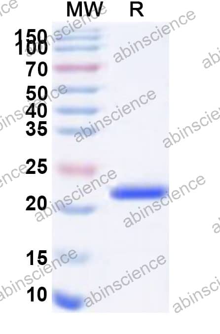 Canine TIM-3 Recombinant Protein (N-His)