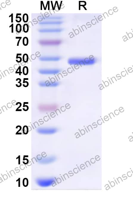 Canine PNLIPRP1/PL-RP1 Recombinant Protein (N-His)