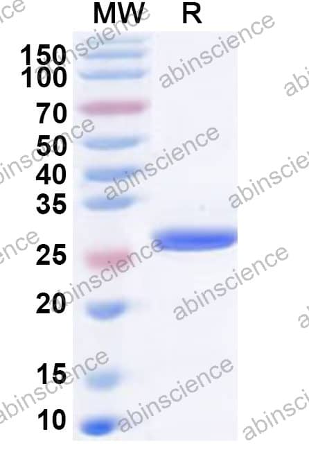 Feline CD122/IL2RB Recombinant Protein (N-His)