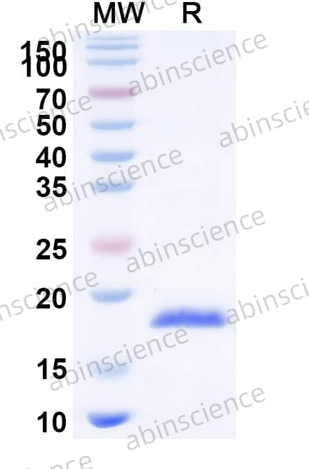 Feline Fel d 4 Recombinant Protein (N-His)
