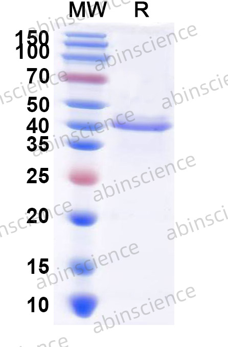 Feline NGF/Beta-NGF Recombinant Protein (C-Fc)