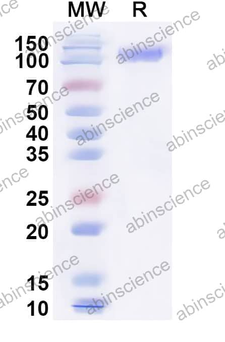 Feline OSMR Recombinant Protein (C-His)