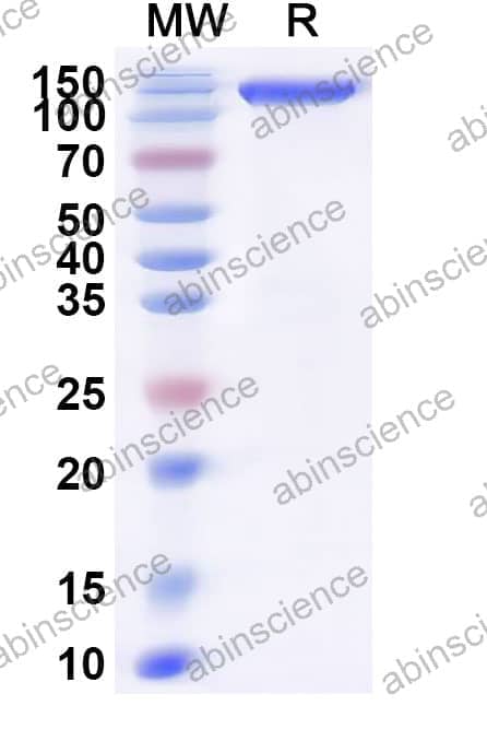 Feline OSMR Recombinant Protein (C-Fc)