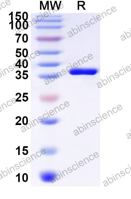 Feline Serum Amyloid A1 Recombinant Protein (N-GST & C-His)