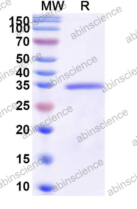 Human DNASE1L2 Recombinant Protein (N-His)
