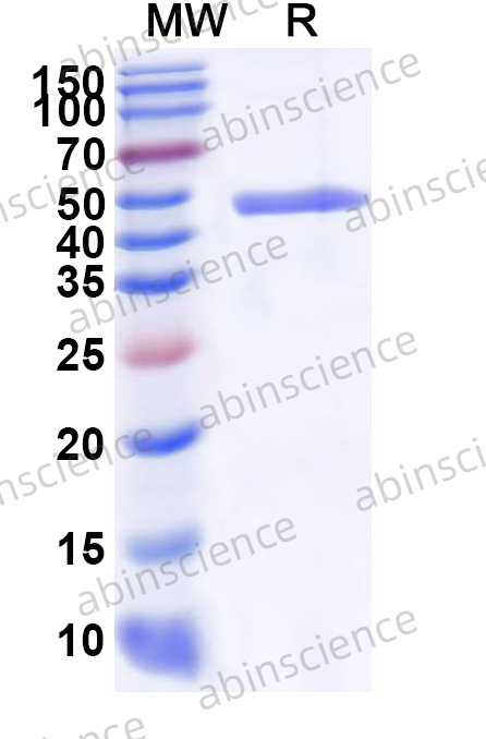 Human Haspin/GSG2 Recombinant Protein (N-His)