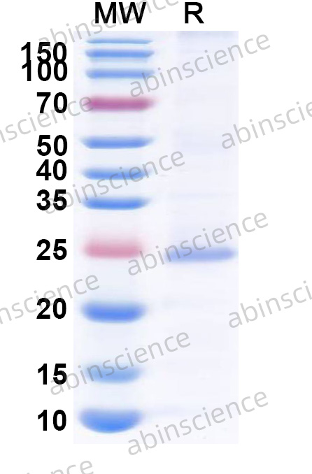 Human PLAC1 Recombinant Protein (N-His)