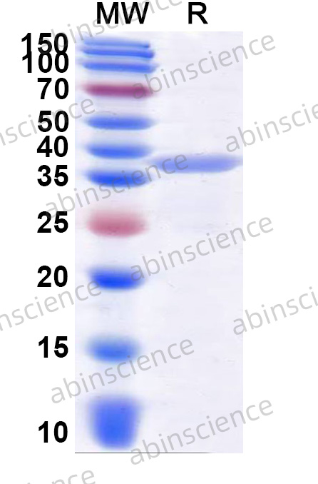 Human FLRT3 Recombinant Protein (N-His)