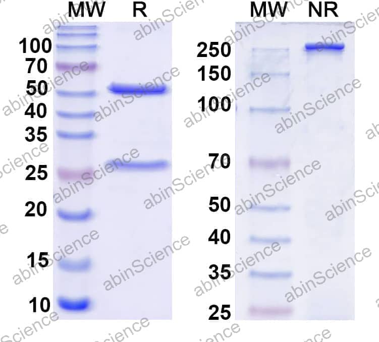 Anti-Nav1.8 Na+ channel Recombinant Antibody (N134/33)