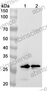 Anti-Human KCNIP4 Polyclonal Antibody