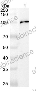 Anti-Human GTSE1 Polyclonal Antibody