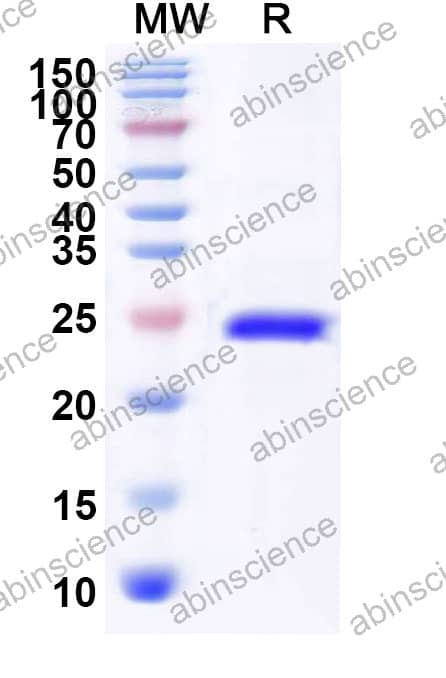Human APOBEC3A Recombinant Protein (C-His)
