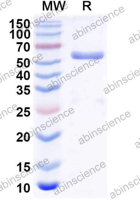 Human TBX21 Recombinant Protein (C-His)