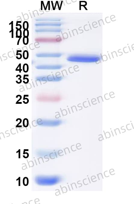 Human DDX5 Recombinant Protein (C-Strep)