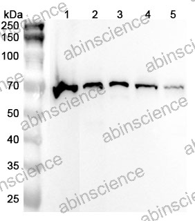 Anti-Human DDX5 Polyclonal Antibody