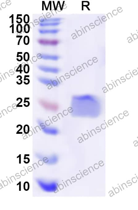 Recombinant Human GPX2 Protein, N-His