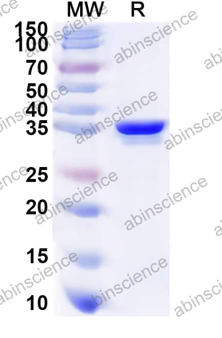 Human CDK11B Recombinant Protein (N-His)