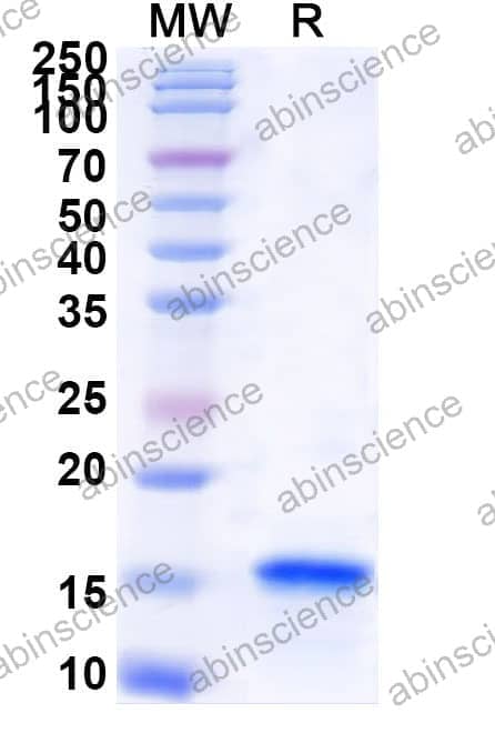 Mouse CA14 Recombinant Protein (N-His)