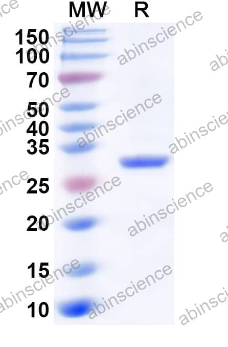 Human CA5A Recombinant Protein (N-His)