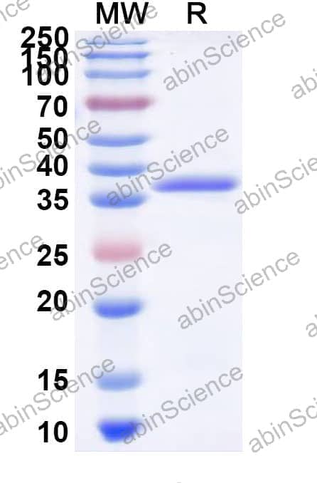 Human CA10 Recombinant Protein (N-His)