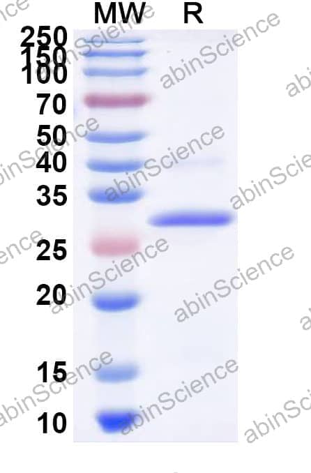 Human CA7 Recombinant Protein (N-His)