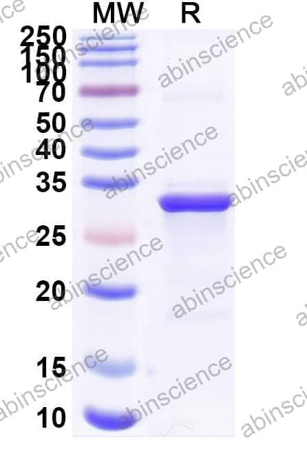Human DAXX Recombinant Protein (N-His)