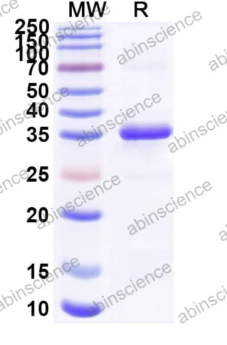 Human NSMCE2 Recombinant Protein (H-His)