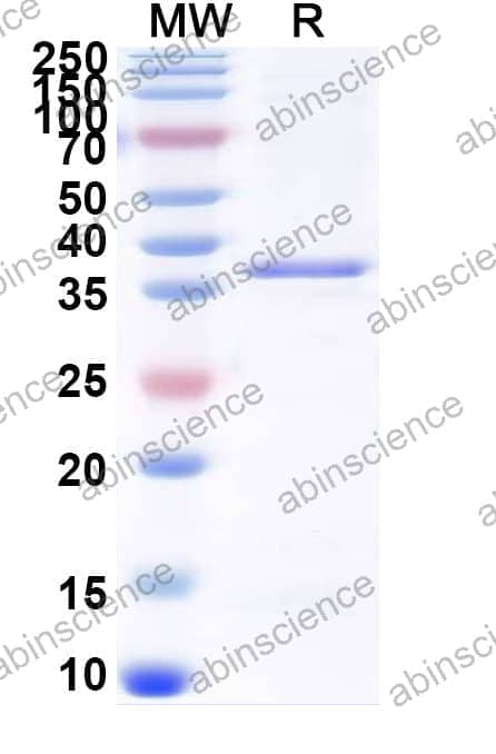 Human NKX2-6 Recombinant Protein (N-GST & C-His)