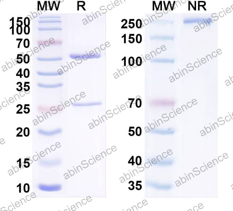 Anti-Human SLC9B2 Recombinant Antibody (SAA2256)