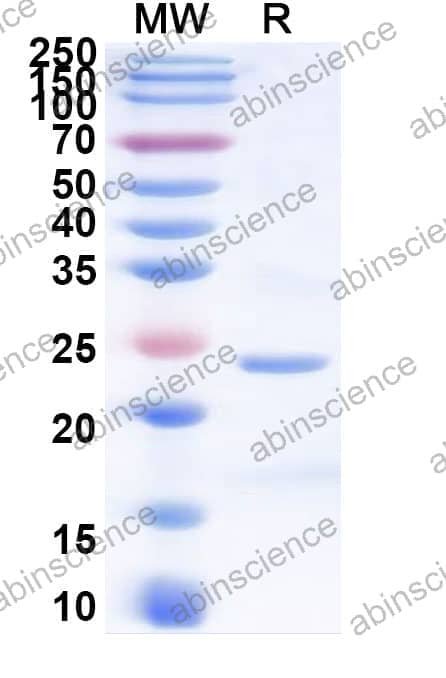 Human Cerebellin-2/CBLN2 Recombinant Protein (C-His)