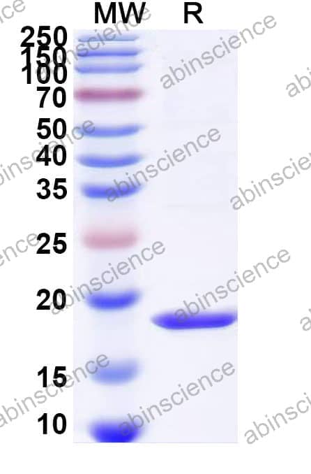 Human Cerebellin-2/CBLN2 Recombinant Protein (N-His)