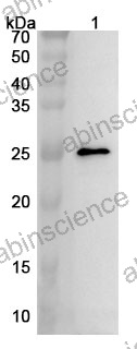 Anti-Cerebellin-2/CBLN2 Polyclonal Antibody