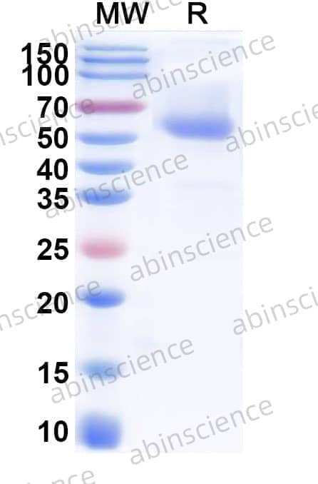 Human Cerebellin-2/CBLN2 Recombinant Protein (C-Fc)