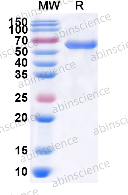 Human RAD21 Recombinant Protein (N-GST & C-His)