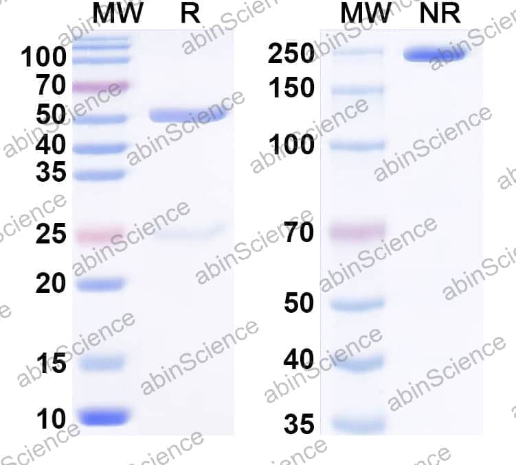 Anti-Human ULBP6 Recombinant Antibody (23ME-01473)