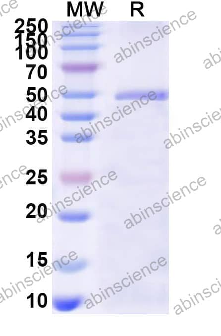 Human BAAT Recombinant Protein (N-His)
