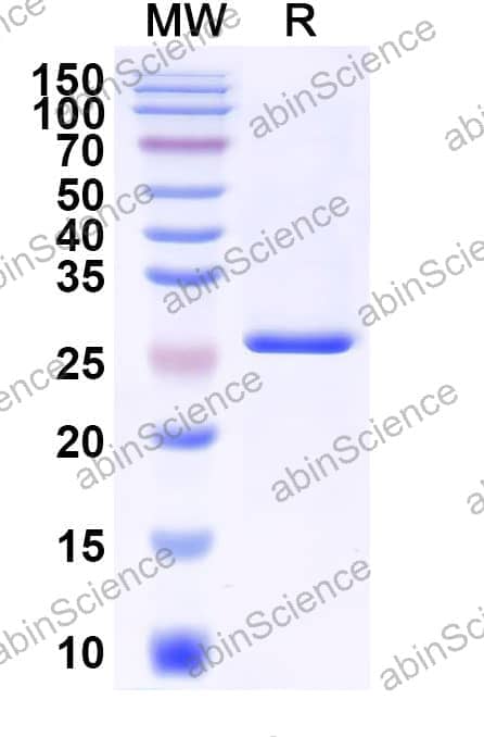 Human TMT1A Recombinant Protein (N-His)