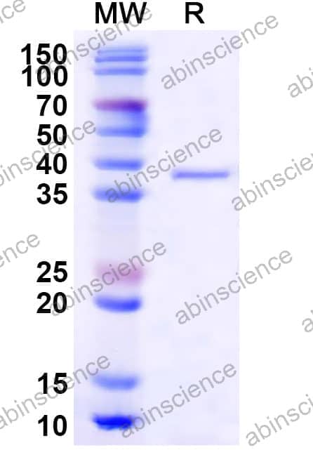 Human CIART Recombinant Protein (N-GST & C-His)