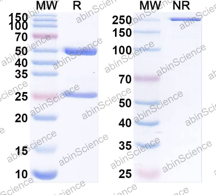 Anti-Titin/Connectin Recombinant Antibody (SAA2265)