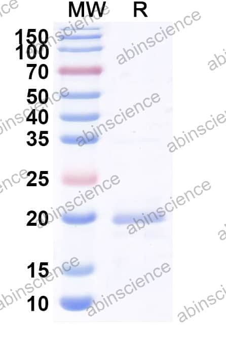 Human Palmdelphin/PALMD Recombinant Protein (N-His)