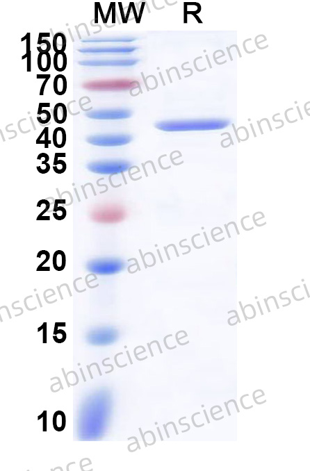 Human Palmdelphin/PALMD Recombinant Protein (N-GST & C-His)