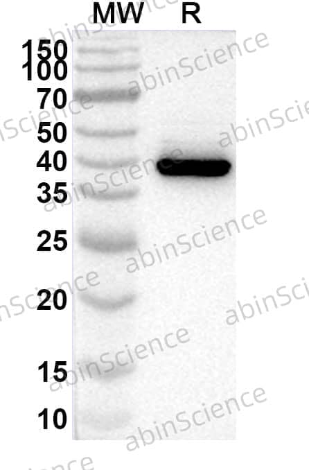 Anti-SLC39A1/ZIP1 Polyclonal Antibody