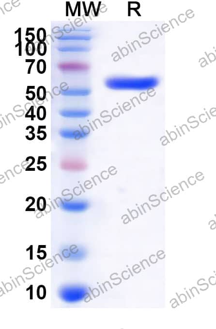 Human CYP1B1 Recombinant Protein (N-GST)