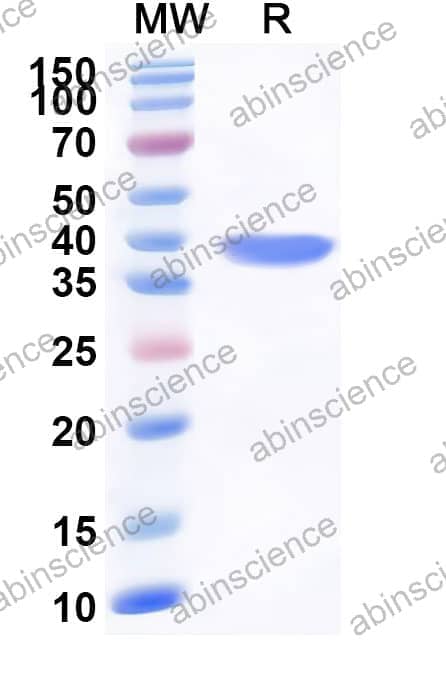 Human KIFC3 Recombinant Protein (N-His)