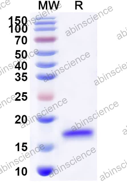 Human NDUFS4 Recombinant Protein (N-His)